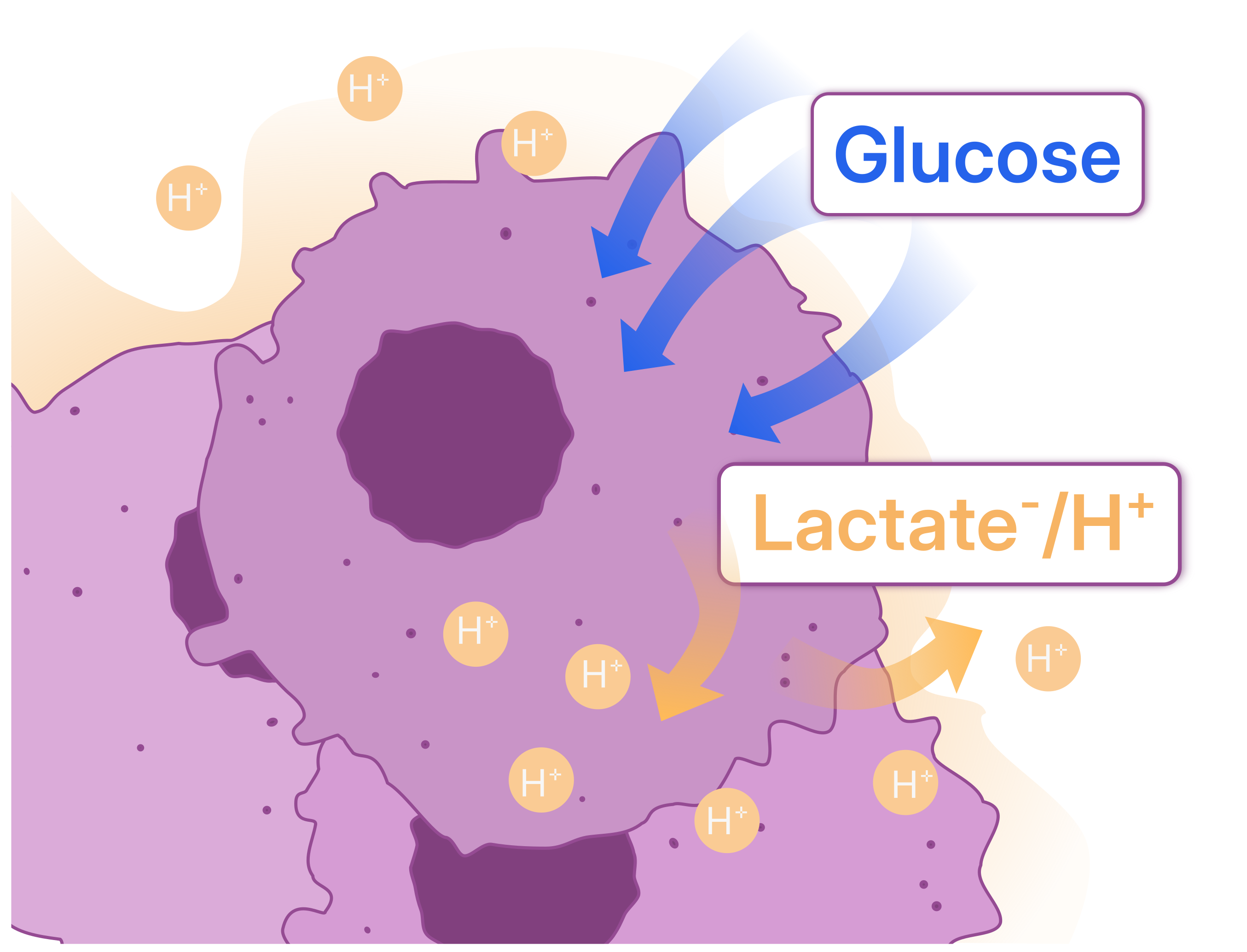 Cancer cells take up glucose and release lactate and protons into the tumor microenvironment